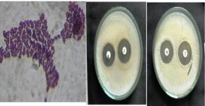 Comparative antibiotic susceptibility profiling of S. haemolyticus recovered from frequency hand-touched surfaces of hospital settings and urban built environments of central India